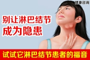 包含雄鹿低迷不振：近期表现不尽如人意引发担忧的词条